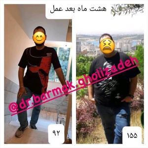 جراحی-چاقی-01