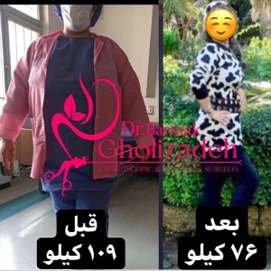 جراحی-چاقی-02