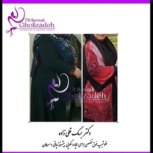 جراحی-چاقی-04
