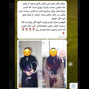 جراحی-چاقی-06