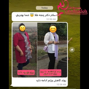 جراحی-چاقی-07