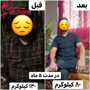 جراحی-چاقی-08