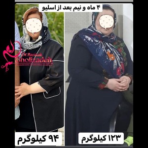 جراحی-چاقی-09