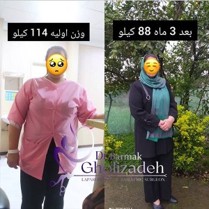 جراحی-چاقی-15