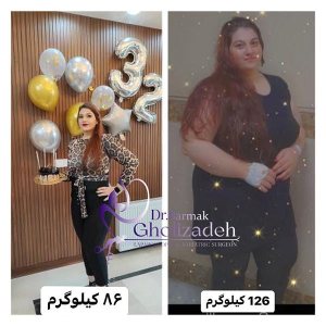 جراحی-چاقی-24