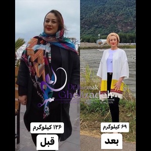 جراحی-چاقی-26