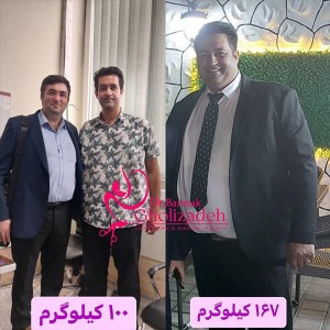 جراحی-چاقی-37