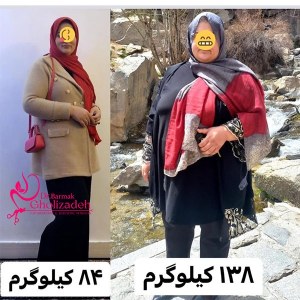 جراحی-چاقی-41