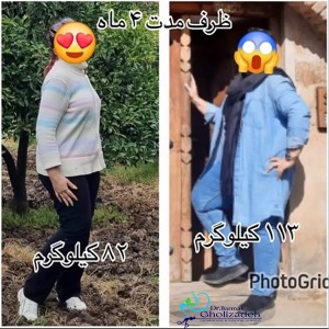 جراحی-چاقی-51