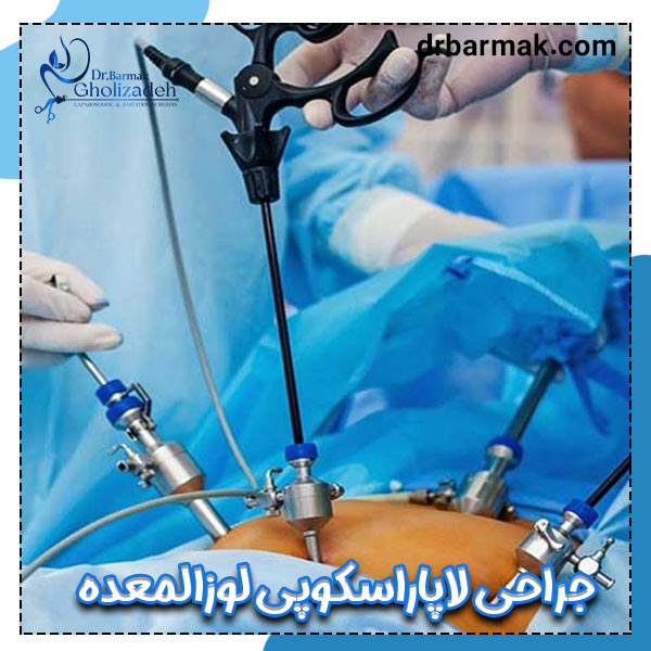 جراحی لاپاراسکوپی لوزالمعده - دکتر برمک قلی زاده