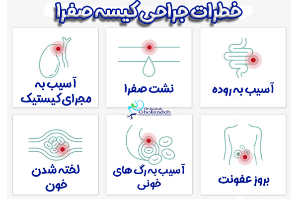 خطرات جراحی کیسه صفرا + دکتر برمک قلی زاده
