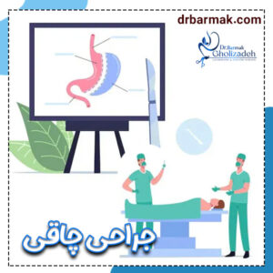 جراحی چاقی - دکتر برمک قلی زاده