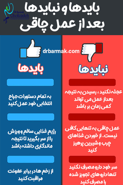 بایدها و نبایدها بعد از عمل چاقی