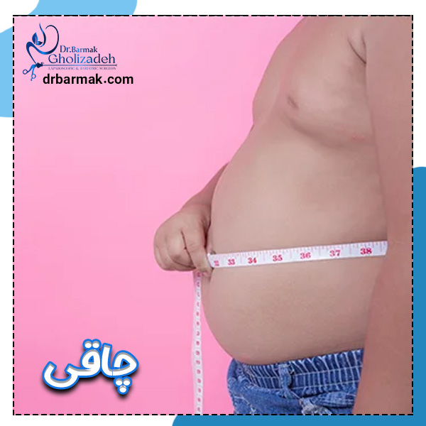 چاقی - دکتر برمک قلی زاده