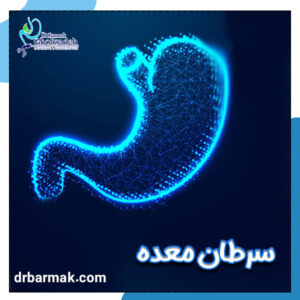 سرطان معده - دکتر برمک قلی زاده