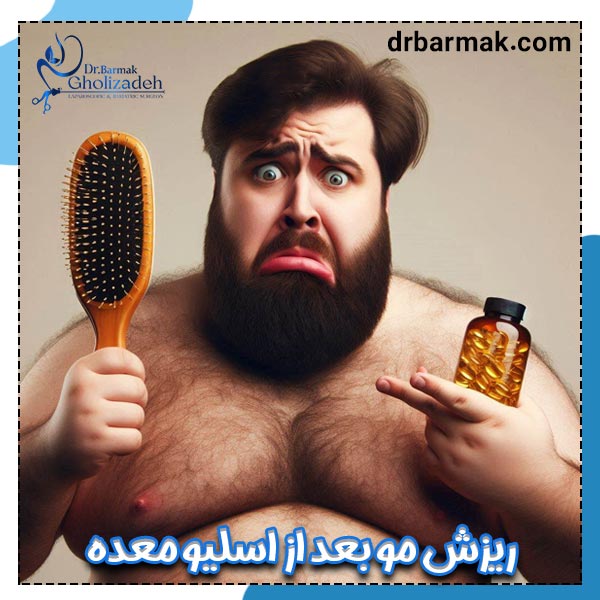 ریزش مو بعد از اسلیو معده - دکتر قلی زاده