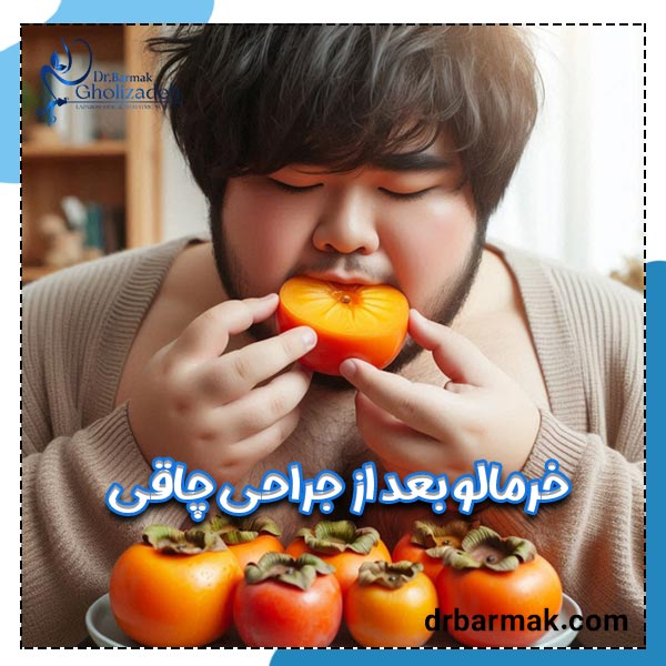 خرمالو بعد اسلیو معده - دکتر برمک قلی زاده