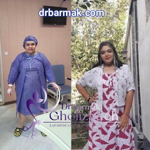 تصاویر رضایت از دکتر برمک قلی زاده - بهترین جراح چاقی