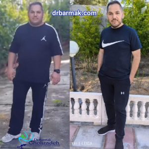 تصاویر رضایت از دکتر برمک قلی زاده - بهترین جراح چاقی