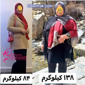 تصاویر رضایت از دکتر برمک قلی زاده - بهترین جراح چاقی
