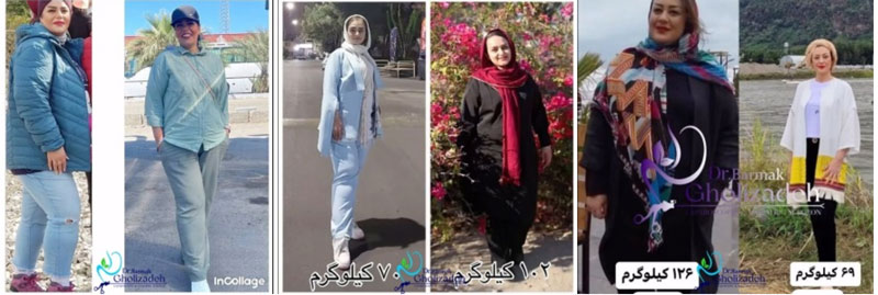 تصاویر رضایت از دکتر برمک قلی زاده - بهترین جراح چاقی