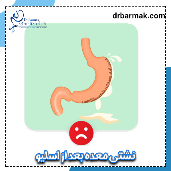نشتی معده بعد از اسلیو - دکتر برمک قلی زاده 