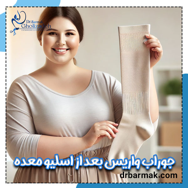 جوراب واریس بعد از اسلیو معده - دکتر برمک قلی زاده