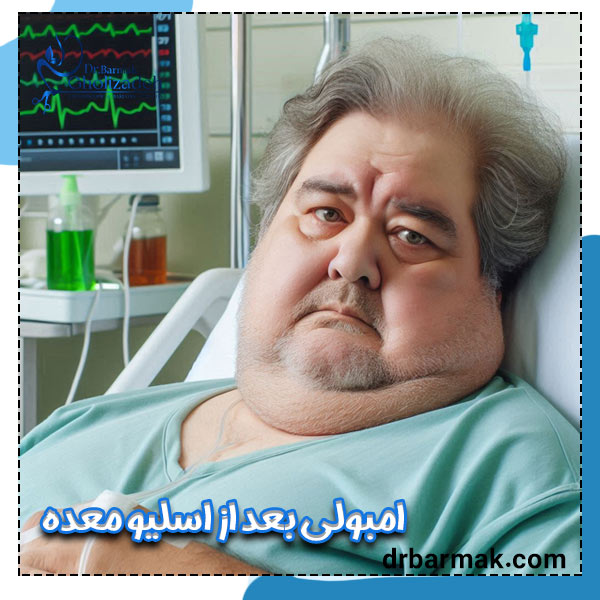 امبولی بعد از اسلیو معده - دکتر برمک قلی زاده
