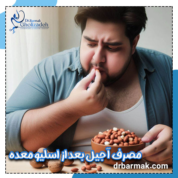 مصرف آجیل بعد از اسلیو معده - دکتر قلی زاده