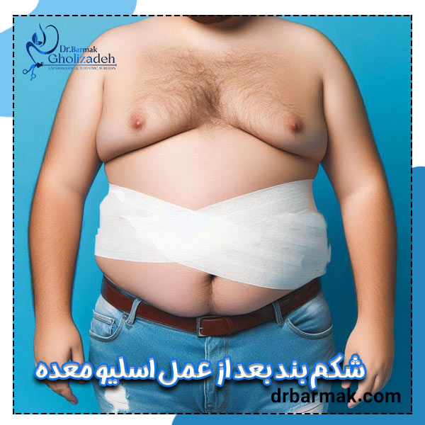 شکم بند بعد از اسلیو معده - دکتر قلی زاده