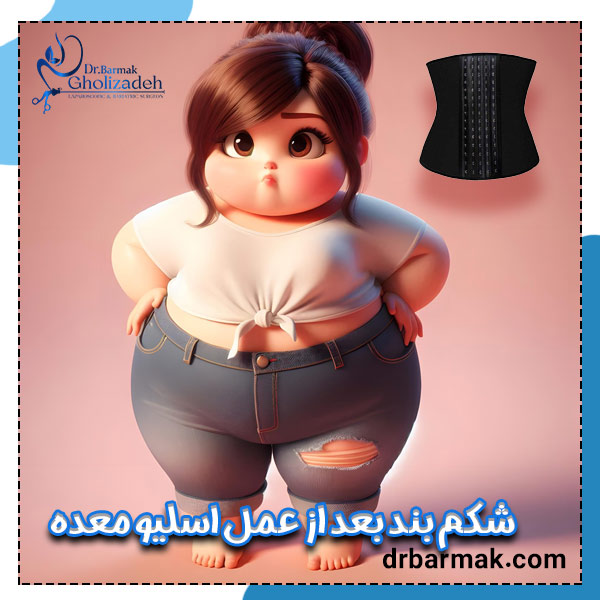 شکم بند بعد از اسلیو معده - دکتر قلی زاده