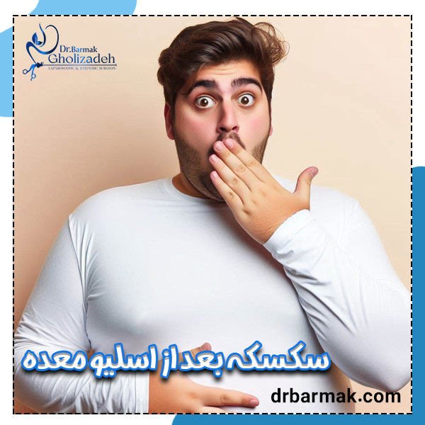سکسکه بعد از اسلیو معده - دکتر قلی زاده
