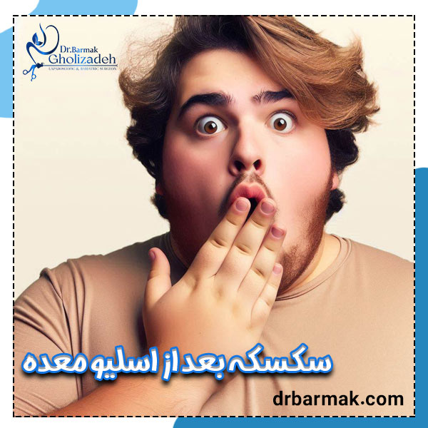 سکسکه بعد از اسلیو معده - دکتر قلی زاده