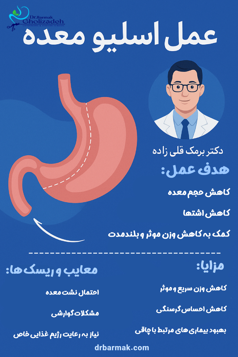 اسلیو معده - دکتر قلی زاده
