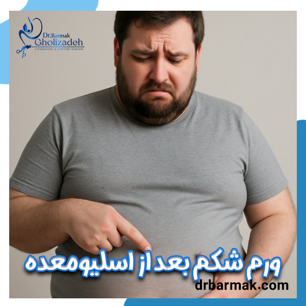 ورم شکم بعد از اسلیو معده - دکتر برمک قلی زاده