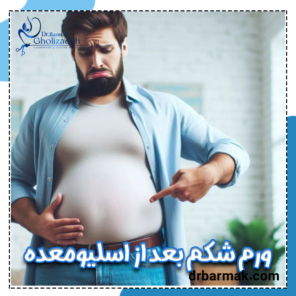 ورم شکم بعد از اسلیو معده - دکتر قلی زاده