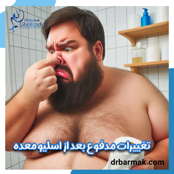 مدفوع بعد از اسلیو معده - دکتر برمک قلی زاده