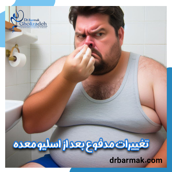 مدفوع بعد از اسلیو معده - دکتر برمک قلی زاده