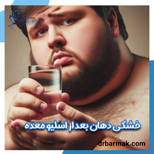خشکی دهان بعد از اسلیو معده | دکتر قلی زاده