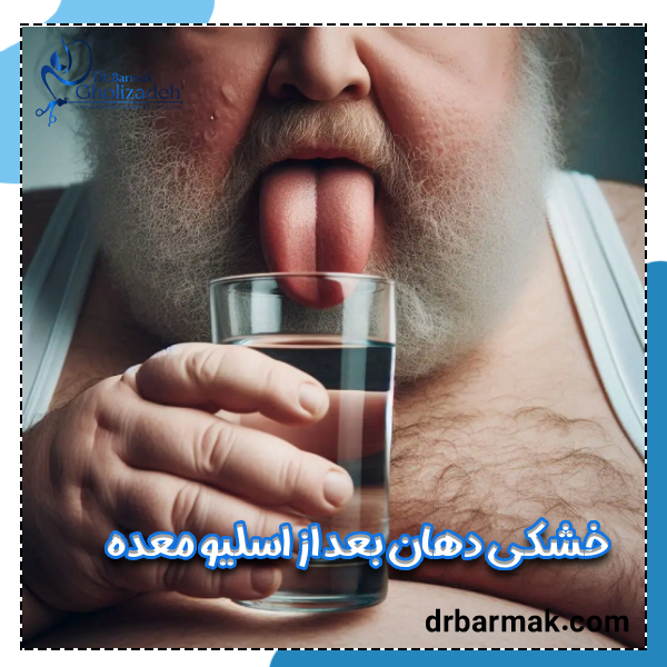 خشکی دهان بعد از اسلیو معده - دکتر قلی زاده