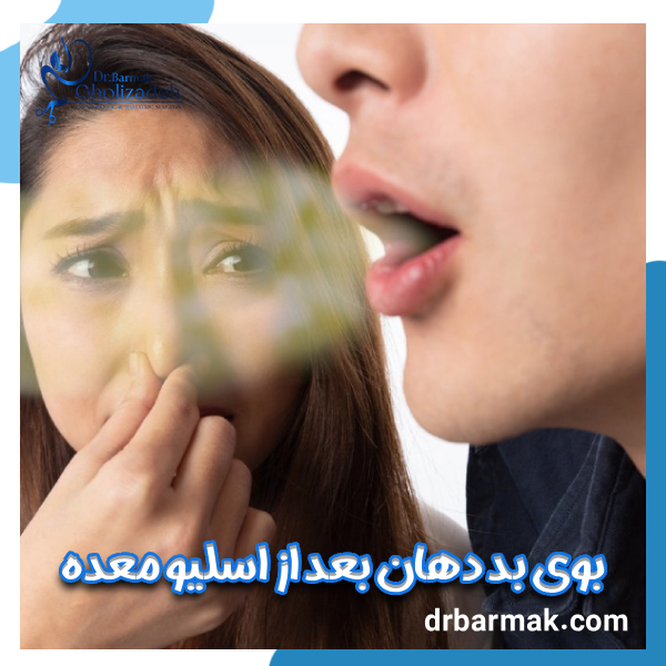 بوی بد دهان بعد از اسلیو معده - دکتر قلی زاده